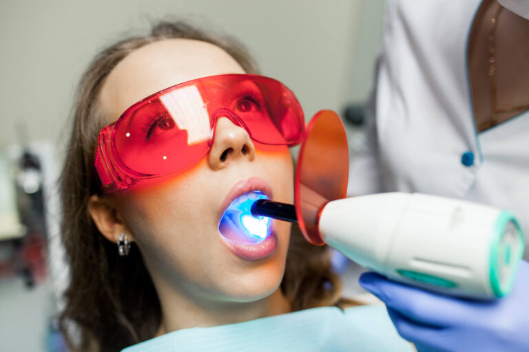 Blanqueamiento Clinica Cosdent
