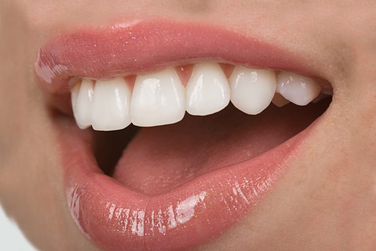 Clinica Dental Costa Rica