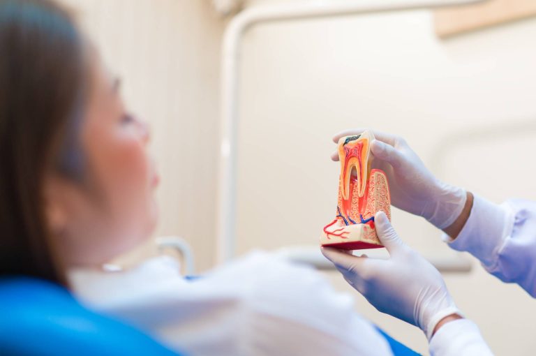 Tratamiento de endodoncia (conducto) en Clínica CosDent, San José