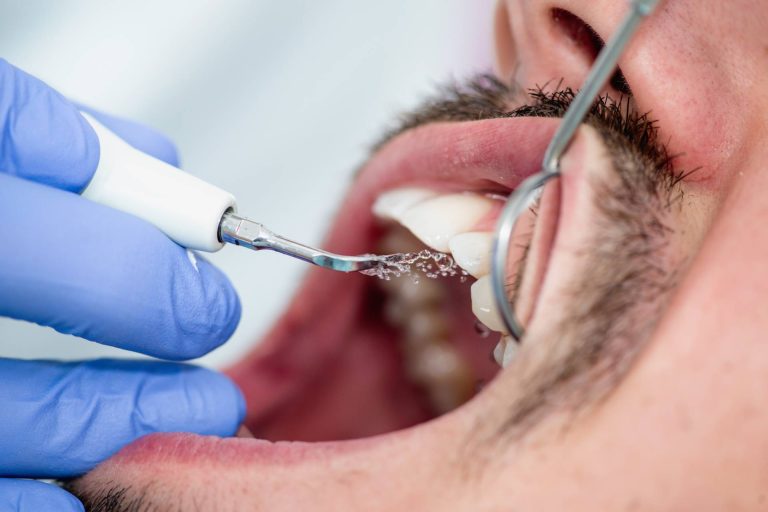 Limpieza Dental CosDent
